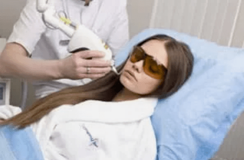 frakční laserové omlazení